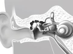 Was ist Tinnitus und was