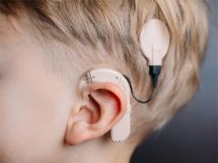 Cochlea-Implantat: Hörprothese für gehörlose Kinder
