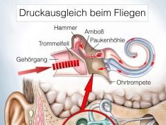 Fliegen und Ohrenschmerzen: Ursachen, Vorbeugung