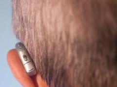 Hörgeräte und Schwerhörigkeit: Ihre Fragen,