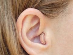 Im-Ohr Hörgeräte: Preise, Kosten und