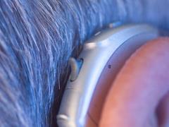 Schallempfindungsschwerhörigkeit: Ursachen einer Innenohrschwerhörigkeit