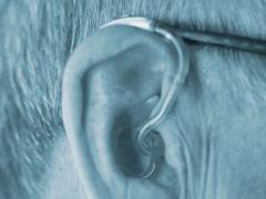 Schwerhörigkeit: Behandlung, Ursachen, Symptome und