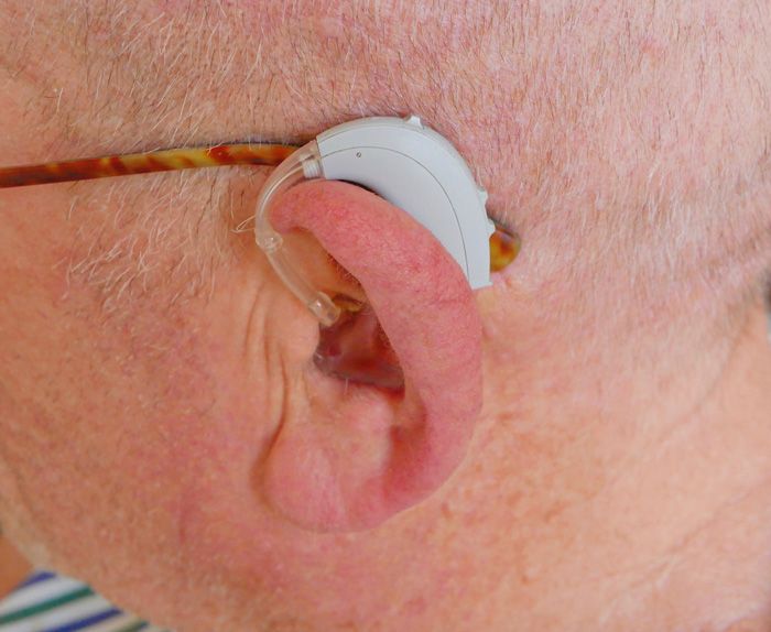 Anpassung beim Hörgeräteakustiker