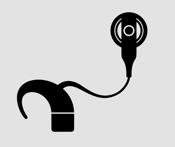 Cochlea Implant