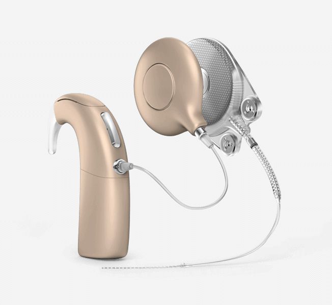 Cochlear Implantate