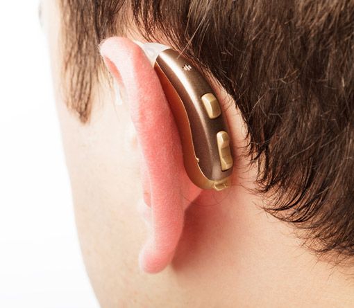 Hinter dem Ohr Hörgerät