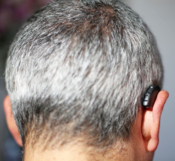 Hochfrequenter Hörverlust