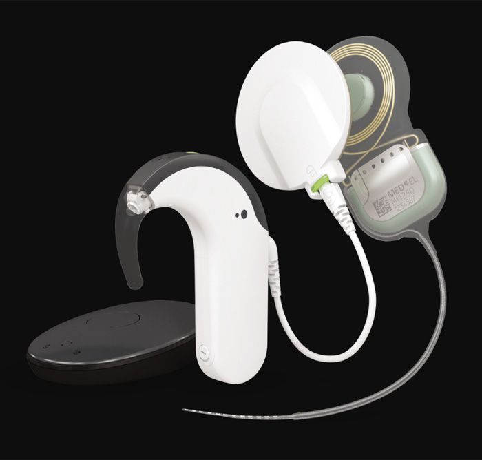 Hörgeräte Implantate