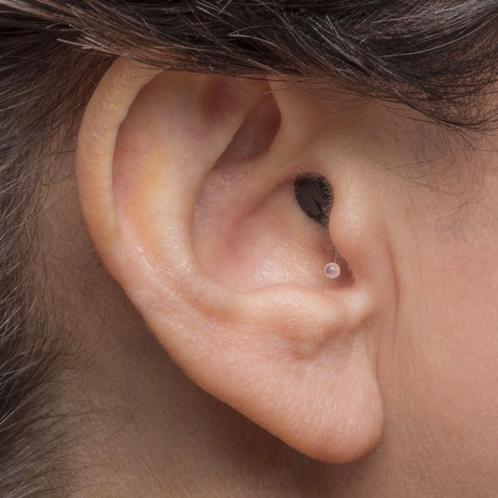 Ohr mit Phonak Hörgerät