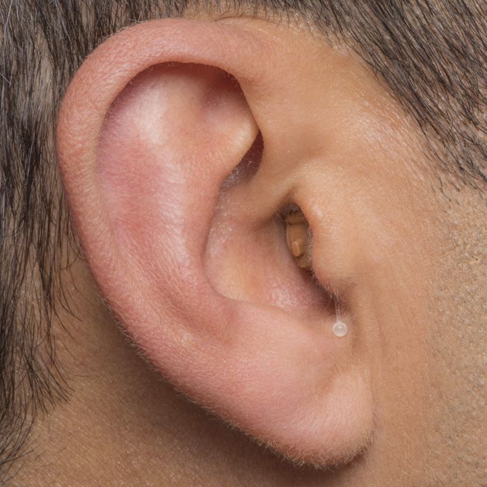 Phonak Komplett im Kanal Hörgerät