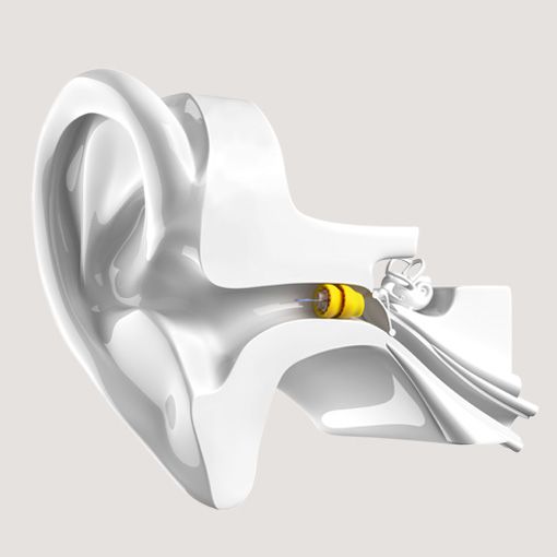 Phonak Lyric Hörgerät