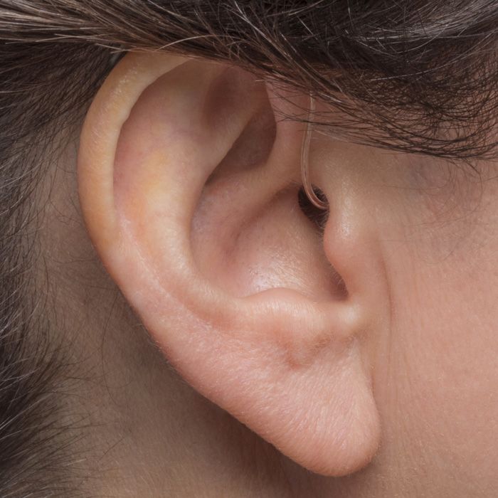 Schallempfindungsschwerhörigkeit