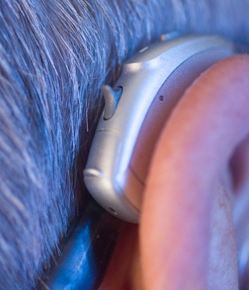 Schallempfindungsschwerhörigkeit