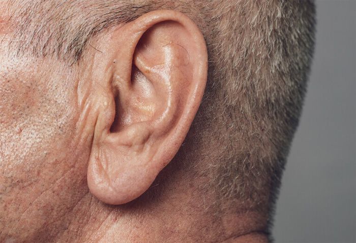 Schweregrad einer Schwerhörigkeit