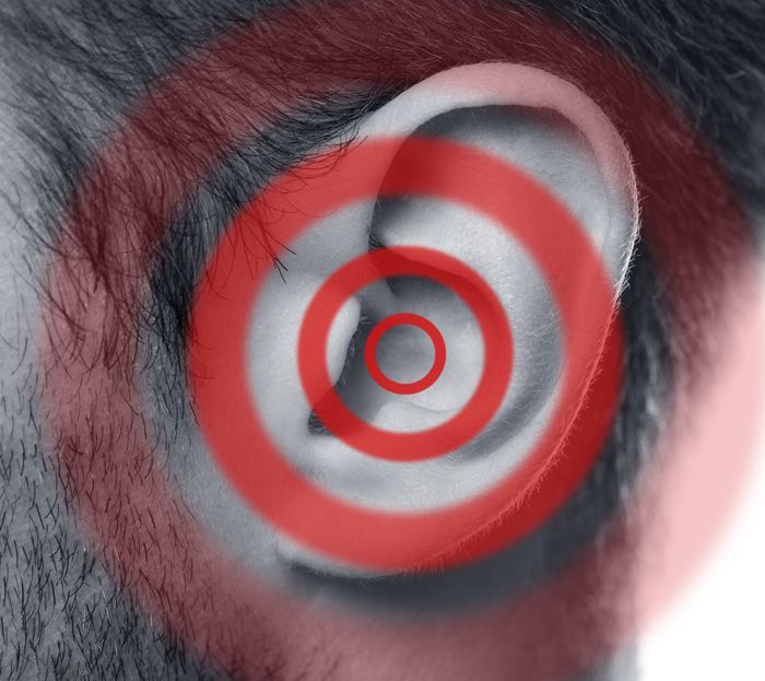 Tinnitus Geräusche
