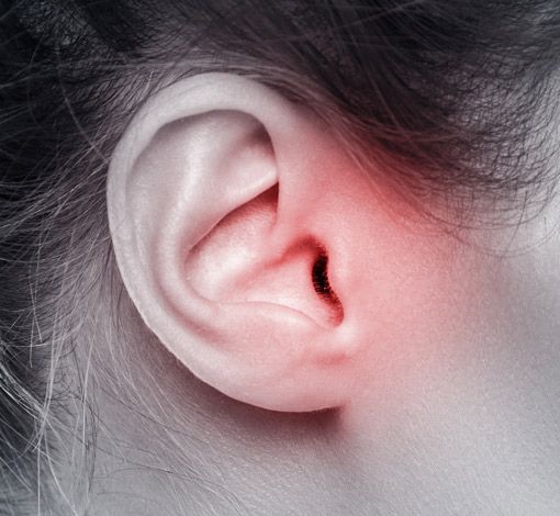 Tinnitus Schmerzen Frau