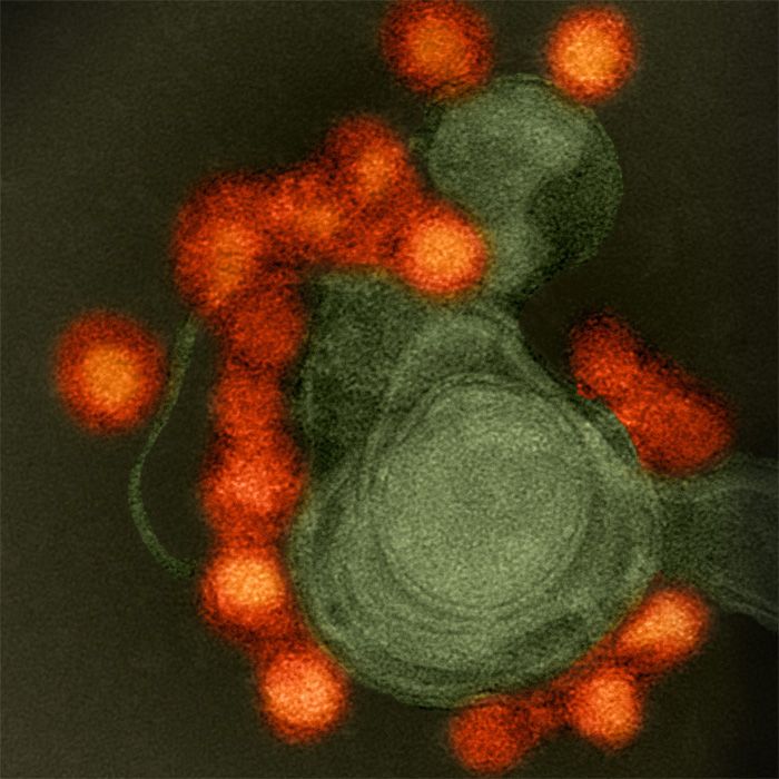 Zika Virus